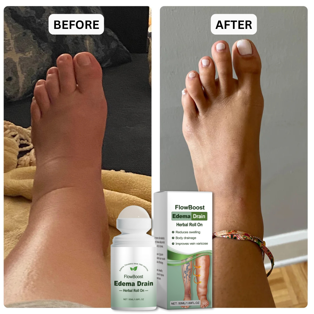 FlowBoost® | Natural and Gentle Support for Tired & Heavy Legs