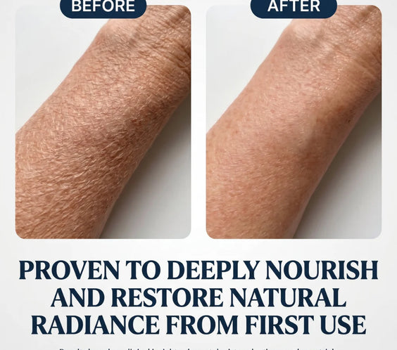 Natural Cooling Roller